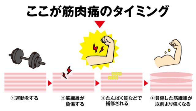 筋肉痛